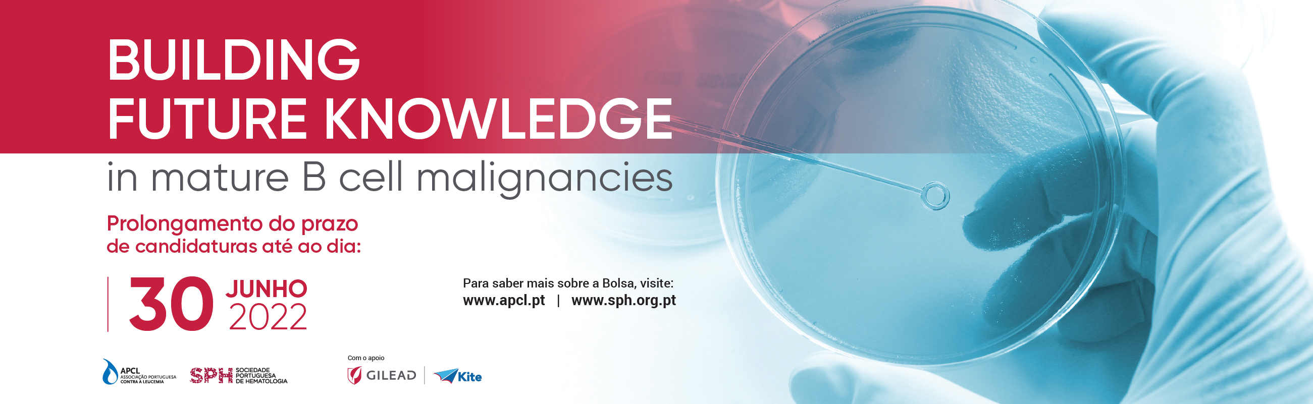 Bolsa APCL, SPH e Gilead: Building Future Knowledge in mature B cell malignacies
